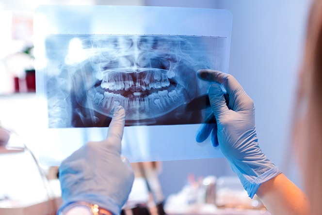 Dentist examining dental X-ray image while wearing gloves in clinical setting.