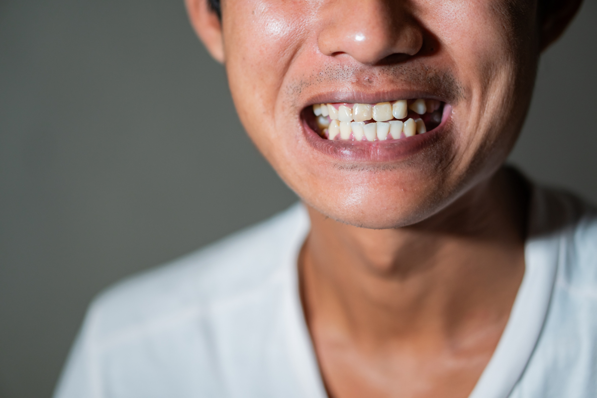 Man displaying a bright, confident smile showcasing cosmetic dental results in Tulsa.