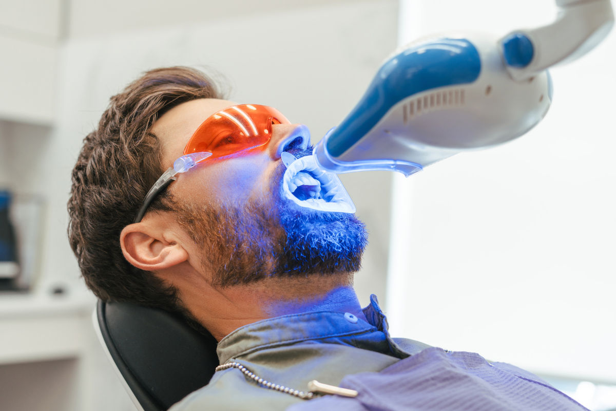 Professional Whitening Procedure