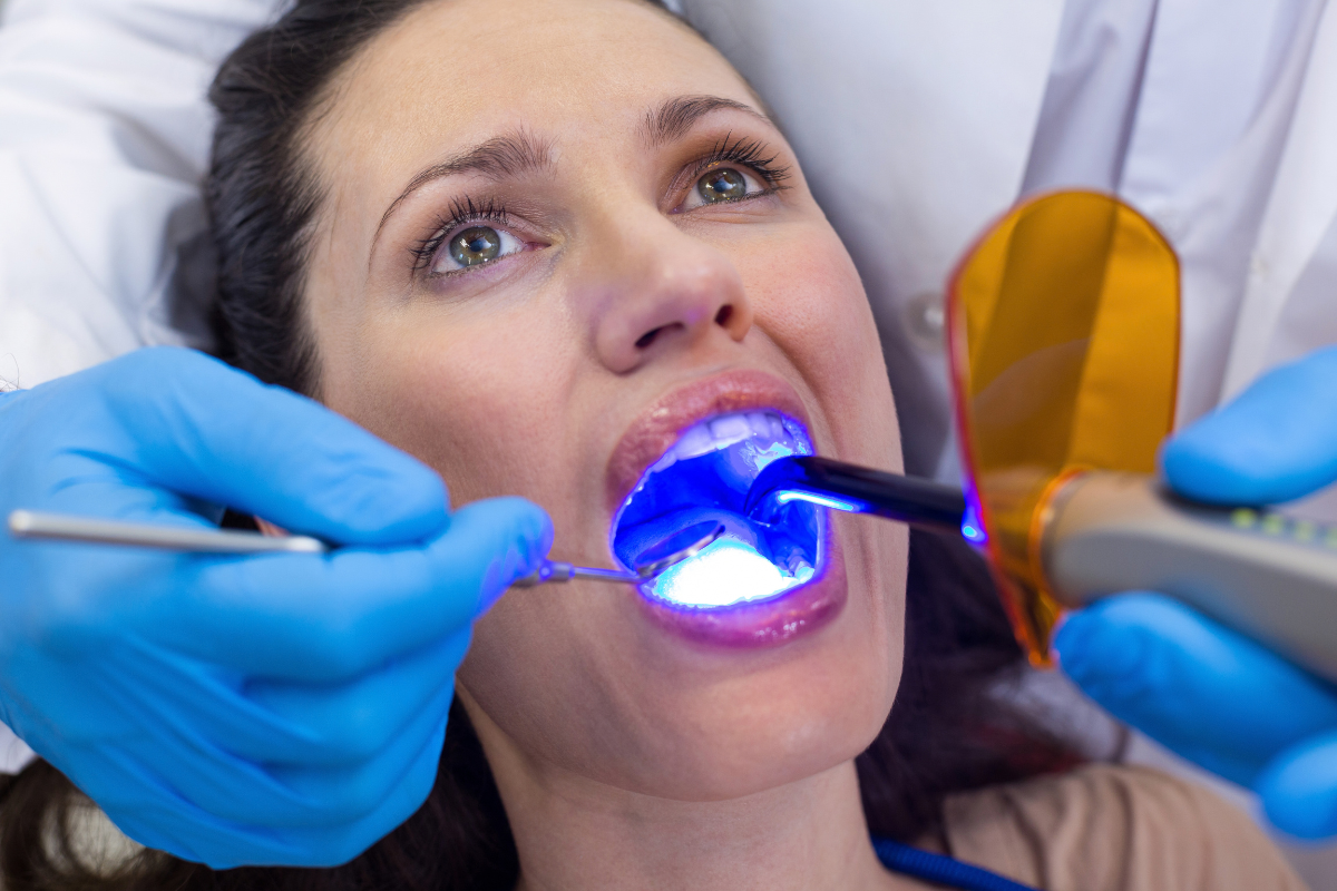 Teeth whitening process